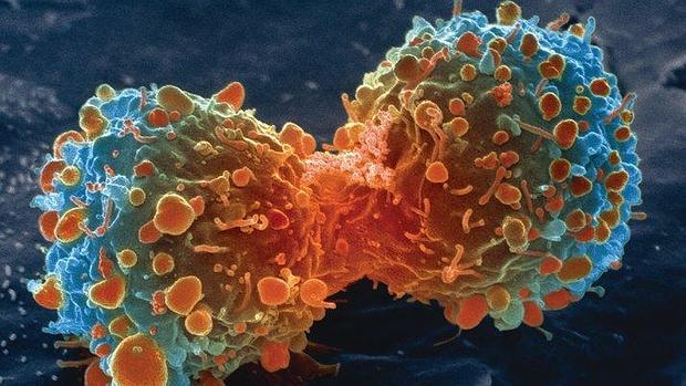 celula-tumoral-cancer-pulmon-cbd
