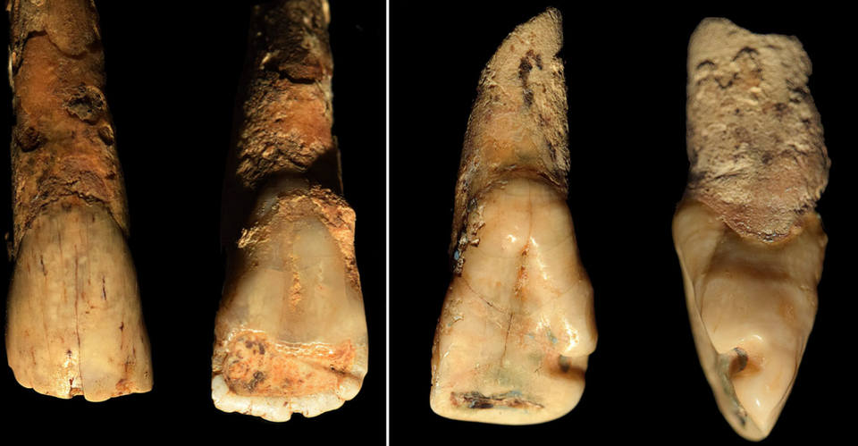dientes con cañamo en la edad de cobre en Italia